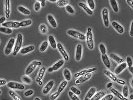 Vue par microscope de brettanomyces